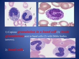 White Cell Precursors.pdf