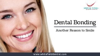 www.whitefielddentist.com
Dental Bonding 
Another Reason to Smile
 