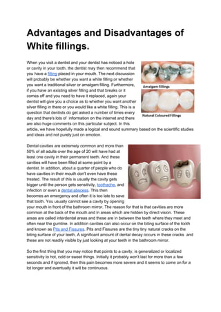 Advantages and Disadvantages of
White fillings.
When you visit a dentist and your dentist has noticed a hole
or cavity in your tooth, the dentist may then recommend that
you have a ​filling​ placed in your mouth. The next discussion
will probably be whether you want a white filling or whether
you want a traditional silver or amalgam filling. Furthermore,
if you have an existing silver filling and that breaks or it
comes off and you need to have it replaced, again your
dentist will give you a choice as to whether you want another
silver filling in there or you would like a white filling. This is a
question that dentists do get asked a number of times every
day and there's lots of information on the internet and there
are also huge comments on this particular subject. In this
article, we have hopefully made a logical and sound summary based on the scientific studies
and ideas and not purely just on emotion.
Dental cavities are extremely common and more than
50% of all adults over the age of 20 will have had at
least one cavity in their permanent teeth. And these
cavities will have been filled at some point by a
dentist. In addition, about a quarter of people who do
have cavities in their mouth don't even have these
treated. The result of this is usually the cavity gets
bigger until the person gets sensitivity, ​toothache​, and
infection or even a ​dental abscess​. This then
becomes an emergency and often it is too late to save
that tooth. You usually cannot see a cavity by opening
your mouth in front of the bathroom mirror. The reason for that is that cavities are more
common at the back of the mouth and in areas which are hidden by direct vision. These
areas are called interdental areas and these are in between the teeth where they meet and
often near the gumline. In addition cavities can also occur on the biting surface of the tooth
and known as ​Pits and Fissures​. Pits and Fissures are the tiny tiny natural cracks on the
biting surface of your teeth. A significant amount of dental decay occurs in these cracks and
these are not readily visible by just looking at your teeth in the bathroom mirror.
So the first thing that you may notice that points to a cavity, is generalized or localized
sensitivity to hot, cold or sweet things. Initially it probably won't last for more than a few
seconds and if ignored, then this pain becomes more severe and it seems to come on for a
lot longer and eventually it will be continuous.
 