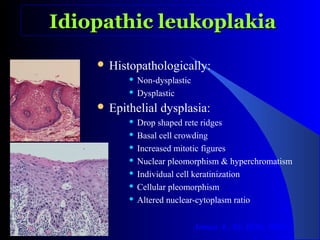 Drop Rete Ridges Oral White lesions | PPT