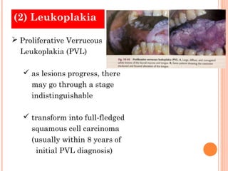 (2) Leukoplakia

 Proliferative Verrucous
  Leukoplakia (PVL)

    as lesions progress, there
     may go through a stage
     indistinguishable

    transform into full-fledged
     squamous cell carcinoma
     (usually within 8 years of
      initial PVL diagnosis)
 