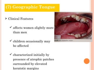 (7) Geographic Tongue

 Clinical Features

    affects women slightly more
     than men

    children occasionally may
     be affected

    characterized initially by
     presence of atrophic patches
     surrounded by elevated
     keratotic margins
 