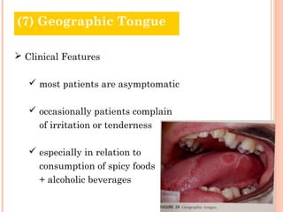 (7) Geographic Tongue

 Clinical Features

    most patients are asymptomatic

    occasionally patients complain
     of irritation or tenderness

    especially in relation to
     consumption of spicy foods
     + alcoholic beverages
 