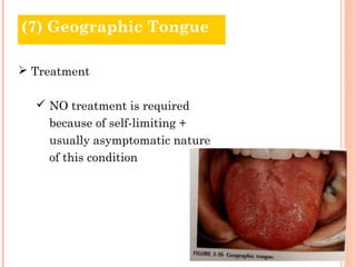 (7) Geographic Tongue

 Treatment

   NO treatment is required
    because of self-limiting +
    usually asymptomatic nature
    of this condition
 