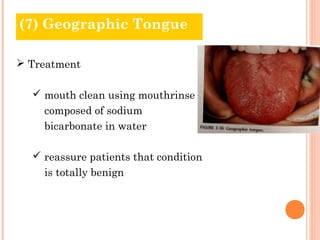(7) Geographic Tongue

 Treatment

   mouth clean using mouthrinse
    composed of sodium
    bicarbonate in water

   reassure patients that condition
    is totally benign
 
