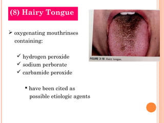 (8) Hairy Tongue

 oxygenating mouthrinses
  containing:

   hydrogen peroxide
   sodium perborate
   carbamide peroxide

       have been cited as
       possible etiologic agents
 