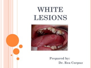 WHITE
LESIONS




   Prepared by:
        Dr. Rea Corpuz
 