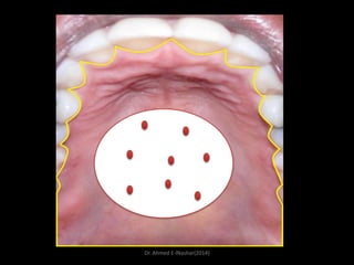 Dr. Ahmed E-lNashar(2014)

 