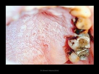 Dr. Ahmed E-lNashar(2014)

 