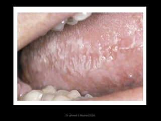 Dr. Ahmed E-lNashar(2014)

 