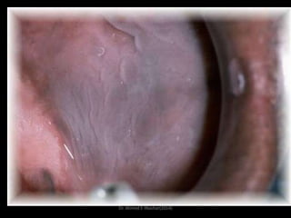 Dr. Ahmed E-lNashar(2014)

 