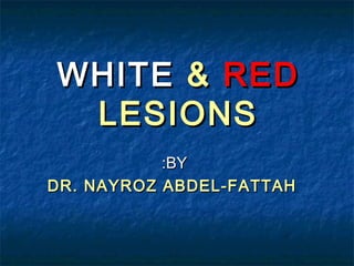 WHITE & RED
LESIONS
:BY
DR. NAYROZ ABDEL-FATTAH

 