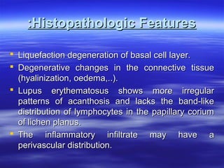 :Histopathologic Features
 Liquefaction degeneration of basal cell layer.
 Degenerative changes in the connective tissue
(hyalinization, oedema,..).
 Lupus erythematosus shows more irregular
patterns of acanthosis and lacks the band-like
distribution of lymphocytes in the papillary corium
of lichen planus.
 The inflammatory infiltrate may have a
perivascular distribution.

 