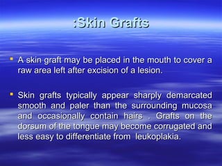 :Skin Grafts
 A skin graft may be placed in the mouth to cover a
raw area left after excision of a lesion.
 Skin grafts typically appear sharply demarcated
smooth and paler than the surrounding mucosa
and occasionally contain hairs . Grafts on the
dorsum of the tongue may become corrugated and
less easy to differentiate from leukoplakia.

 