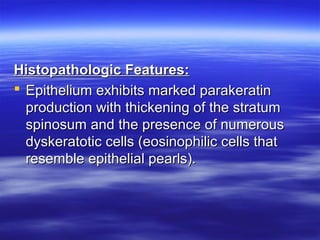 Histopathologic Features:
 Epithelium exhibits marked parakeratin
production with thickening of the stratum
spinosum and the presence of numerous
dyskeratotic cells (eosinophilic cells that
resemble epithelial pearls).

 