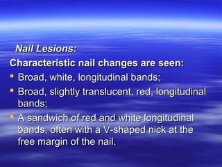 Nail Lesions:
Characteristic nail changes are seen:
 Broad, white, longitudinal bands;
 Broad, slightly translucent, red, longitudinal
bands;
 A sandwich of red and white longitudinal
bands, often with a V-shaped nick at the
free margin of the nail.

 