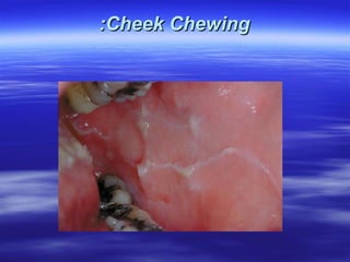 :Cheek Chewing

 