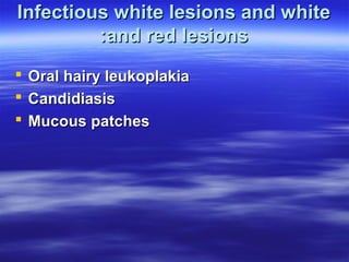 Infectious white lesions and white
:and red lesions




Oral hairy leukoplakia
Candidiasis
Mucous patches

 
