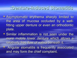 :Denture-induced Stomatitis
 Asymptomatic erythema sharply limited to
the area of mucosa occluded by a wellfitting upper denture or even an orthodontic
plate.
 Similar inflammation is not seen under the
more mobile lower denture which allows a
relatively free flow of saliva beneath it.
 Angular stomatitis is frequently associated
and may form the chief complaint.

 