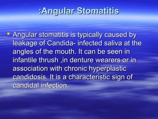 :Angular Stomatitis
 Angular stomatitis is typically caused by
leakage of Candida- infected saliva at the
angles of the mouth. It can be seen in
infantile thrush ,in denture wearers or in
association with chronic hyperplastic
candidosis. It is a characteristic sign of
candidal infection.

 