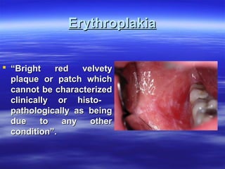 Erythroplakia
 “Bright
red
velvety
plaque or patch which
cannot be characterized
clinically or histopathologically as being
due
to
any
other
condition”.

 