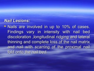 Nail Lesions:
 Nails are involved in up to 10% of cases.
Findings vary in intensity with nail bed
discoloration ,longitudinal ridging and lateral
thinning and complete loss of the nail matrix
and nail with scarring of the proximal nail
fold onto the nail bed.

 