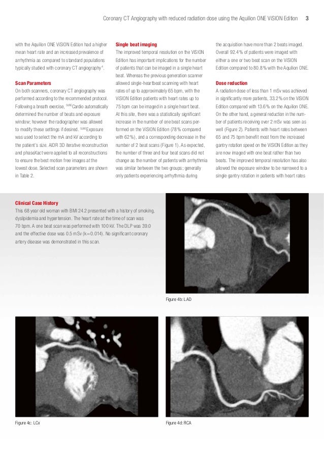 radiation exposure essays Mobile phone radiation and health for radio stations, icnirp proposes two safety levels: one for occupational exposure, another one for the general population. radiation exposure essays Mobile phone radiation and health for radio stations, icnirp proposes two safety levels: one for occupational exposure, another one for the general population.