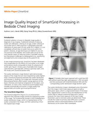 White Paper | SmartGrid
Image Quality Impact of SmartGrid Processing in
Bedside Chest Imaging
Authors: Lori L. Barski (MS), Dong Yang (Ph.D.), Mary Couwenhoven (MS)
Introduction
Scattered radiation is known to degrade image quality in
diagnostic X-ray imaging. Traditional methods of reducing
scatter are collimation, utilizing an air-gap, and/or utilizing an
anti-scatter grid [1]. Best practices in radiography prescribe
collimation on every exam [2] and, while this is helpful, it is not
completely sufficient due to scatter that occurs within the
patient. Likewise, air-gap techniques are helpful [1], but are
not practical at the bedside. Anti-scatter grids are by far the
most popular means of reducing scatter in portable imaging,
but they present challenges to radiographers (e.g., positioning
and alignment) and increases dose to the patient [1,3].
A new image processing tool, SmartGrid, has been developed
that compensates for the effects of X-ray scatter in an image,
and produces results comparable to those of a physical anti-
scatter grid. Figure 1 shows a pair of portable chest images
captured with a grid (top left), without a grid (top right), and
the results with SmartGrid (bottom left).
The scatter distribution image (bottom right) demonstrates
regions of the image that are most impacted by scatter (lighter
tone). SmartGrid processing estimates the scatter distribution
and removes it, resulting in an image with improved contrast.
Many physical factors affect scatter: energy spectrum of the
beam, thickness and material composition of the object, and
collimation, to name a few. SmartGrid accommodates these
variables automatically and results in image quality that
approximates anti-scatter grid visual performance.
The SmartGrid Algorithm
The SmartGrid algorithm (Figure 2) is an enhancement
algorithm that improves image contrast by suppressing scatter
in the image. The fundamental concept is one of developing a
scatter distribution image, which is a representation of the
scatter contained in the image, and then subtracting it from
the original input image.
Figure 1. Portable chest exam captured with a grid (top left)
and without a grid (top right, grid exposure 1.25X non-grid),
and then processed with SmartGrid (bottom left) with the
corresponding scatter distribution image (bottom right).
The scatter distribution image is developed using information
from the image in both linear exposure space as well as
attenuation space, which is a log transformation of the linear
data. Segmentation is done to focus the development of the
scatter field on relevant anatomical data and is used to
compute the mean linear exposure of the input image.
Parameters used to estimate scatter are determined. These
include the scatter-to-primary ratio (SPR) and a curvature
parameter used to control perturbation of the scatter
distribution as the scatter field is developed.
 