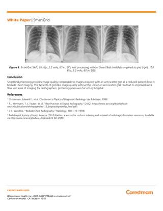 Whitepaper: Image Quality Impact of SmartGrid Processing in Bedside ...