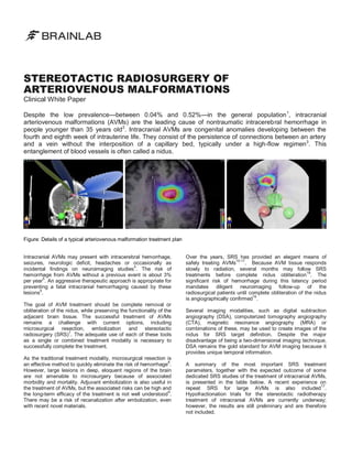 STEREOTACTIC RADIOSURGERY OF
ARTERIOVENOUS MALFORMATIONS
Clinical White Paper

Despite the low prevalence—between 0.04% and 0.52%—in the general population 1, intracranial
arteriovenous malformations (AVMs) are the leading cause of nontraumatic intracerebral hemorrhage in
people younger than 35 years old 2. Intracranial AVMs are congenital anomalies developing between the
fourth and eighth week of intrauterine life. They consist of the persistence of connections between an artery
and a vein without the interposition of a capillary bed, typically under a high-flow regimen3. This
entanglement of blood vessels is often called a nidus.

Figure: Details of a typical arteriovenous malformation treatment plan
Intracranial AVMs may present with intracerebral hemorrhage,
seizures, neurologic deficit, headaches or occasionally as
incidental findings on neuroimaging studies4. The risk of
hemorrhage from AVMs without a previous event is about 3%
5
per year . An aggressive therapeutic approach is appropriate for
preventing a fatal intracranial hemorrhaging caused by these
6
lesions .
The goal of AVM treatment should be complete removal or
obliteration of the nidus, while preserving the functionality of the
adjacent brain tissue. The successful treatment of AVMs
remains a challenge with current options, including
microsurgical resection, embolization and stereotactic
7
radiosurgery (SRS) . The adequate use of each of these tools
as a single or combined treatment modality is necessary to
successfully complete the treatment.
As the traditional treatment modality, microsurgical resection is
an effective method to quickly eliminate the risk of hemorrhage8.
However, large lesions in deep, eloquent regions of the brain
are not amenable to microsurgery because of associated
morbidity and mortality. Adjuvant embolization is also useful in
the treatment of AVMs, but the associated risks can be high and
9
the long-term efficacy of the treatment is not well understood .
There may be a risk of recanalization after embolization, even
with recent novel materials.

Over the years, SRS has provided an elegant means of
10-17
. Because AVM tissue responds
safely treating AVMs
slowly to radiation, several months may follow SRS
treatments before complete nidus obliteration18. The
significant risk of hemorrhage during this latency period
mandates diligent neuroimaging follow-up of the
radiosurgical patients until complete obliteration of the nidus
19
is angiographically confirmed .
Several imaging modalities, such as digital subtraction
angiography (DSA), computerized tomography angiography
(CTA), magnetic resonance angiography (MRA) or
combinations of these, may be used to create images of the
nidus for SRS target definition. Despite the major
disadvantage of being a two-dimensional imaging technique,
DSA remains the gold standard for AVM imaging because it
provides unique temporal information.
A summary of the most important SRS treatment
parameters, together with the expected outcome of some
dedicated SRS studies of the treatment of intracranial AVMs,
is presented in the table below. A recent experience on
17
repeat SRS for large AVMs is also included .
Hypofractionation trials for the stereotactic radiotherapy
treatment of intracranial AVMs are currently underway;
however, the results are still preliminary and are therefore
not included.

 