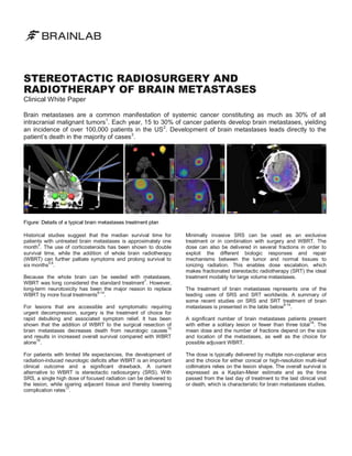 STEREOTACTIC RADIOSURGERY AND
RADIOTHERAPY OF BRAIN METASTASES
Clinical White Paper

Brain metastases are a common manifestation of systemic cancer constituting as much as 30% of all
intracranial malignant tumors1. Each year, 15 to 30% of cancer patients develop brain metastases, yielding
an incidence of over 100,000 patients in the US2. Development of brain metastases leads directly to the
patient’s death in the majority of cases 3.

Figure: Details of a typical brain metastases treatment plan
Historical studies suggest that the median survival time for
patients with untreated brain metastases is approximately one
4
month . The use of corticosteroids has been shown to double
survival time, while the addition of whole brain radiotherapy
(WBRT) can further palliate symptoms and prolong survival to
5,6
six months .
Because the whole brain can be seeded with metastases,
WBRT was long considered the standard treatment7. However,
long-term neurotoxicity has been the major reason to replace
8-14
WBRT by more focal treatments .
For lesions that are accessible and symptomatic requiring
urgent decompression, surgery is the treatment of choice for
rapid debulking and associated symptom relief. It has been
shown that the addition of WBRT to the surgical resection of
15
brain metastases decreases death from neurologic causes
and results in increased overall survival compared with WBRT
16
alone .
For patients with limited life expectancies, the development of
radiation-induced neurologic deficits after WBRT is an important
clinical outcome and a significant drawback. A current
alternative to WBRT is stereotactic radiosurgery (SRS). With
SRS, a single high dose of focused radiation can be delivered to
the lesion, while sparing adjacent tissue and thereby lowering
17
complication rates .

Minimally invasive SRS can be used as an exclusive
treatment or in combination with surgery and WBRT. The
dose can also be delivered in several fractions in order to
exploit the different biologic responses and repair
mechanisms between the tumor and normal tissues to
ionizing radiation. This enables dose escalation, which
makes fractionated stereotactic radiotherapy (SRT) the ideal
treatment modality for large volume metastases.
The treatment of brain metastases represents one of the
leading uses of SRS and SRT worldwide. A summary of
some recent studies on SRS and SRT treatment of brain
8-14
metastases is presented in the table below .
A significant number of brain metastases patients present
18
with either a solitary lesion or fewer than three total . The
mean dose and the number of fractions depend on the size
and location of the metastases, as well as the choice for
possible adjuvant WBRT.
The dose is typically delivered by multiple non-coplanar arcs
and the choice for either conical or high-resolution multi-leaf
collimators relies on the lesion shape. The overall survival is
expressed as a Kaplan-Meier estimate and as the time
passed from the last day of treatment to the last clinical visit
or death, which is characteristic for brain metastases studies.

 