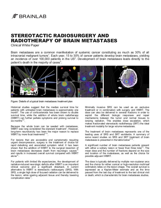 Stereotactic Radiosurgery and Radiotherapy of Brain Metastases Clinic…