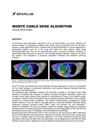 MONTE CARLO DOSE ALGORITHM
Clinical White Paper

ABSTRACT
Conventional dose calculation algorithms, such as Pencil Beam are proven effective for
tumors located in homogeneous regions with similar tissue consistency such as the brain.
However, these algorithms tend to overestimate the dose distribution in tumors diagnosed in
extracranial regions such as in the lung and head and neck regions where large
inhomogeneities exist. Due to the inconsistencies seen in current calculation methods for
homogeneities
extracranial treatments and the need for more precise radiation delivery, research has led to
the creation and integration of improved calculation methods into treatmen planning
treatment
software.

Figure 1: The Monte Carlo (XVMC) Dose Algorithm (right) simulates rotational treatments continuously while Semi Analytical Dose
Algorithms (left) show discretization artifacts.

iPlan® RT Dose with Monte Carlo from Brainlab has been developed in order to compensate
for this under dosage in extracranial calculations and improve radiation treatment planning
accuracy for clinical practice.
The advanced dose calculation solution from Brainlab is based on the Monte Carlo (MC)
Brainlab
method of modelling the transport of radiation through the beam collimation system and
through human tissue. Monte Carlo requires a 3-dimensional CT-scan of the patient's tissue
3
scan
to create an internal model of the patient and to calculate the dose distribution of the radiation
patient
emitted by a medical linear accelerator. The present implementation is designed to model
photon radiation. It can be used to calculate dose for conformal Multileaf Collimator (MLC)
treatments including conformal beam, IMRT, static and dynamic arc and HybridArcTM
ing
treatment modalities. The MLC and patient models are created using interaction parameter
tabulations from the National Institute of Standards and Technology (NIST) of the USA and the
International Commission on Radiation Units and Measurements (ICRU).
ional
Studies have shown that Monte Carlo is more accurate for arc and dynamic IMRT treatments
since the MC algorithm simulates gantry rotations and dynamic leaf movements continuously
and not in discrete steps as with other algorithms. For these treatments the Monte Carlo
ete
calculation might even be faster than the pencil beam. As an integral part of the iPlan RT Dose
software, Monte Carlo is designed to provide additional dose planning choice for the clinical
cl

 