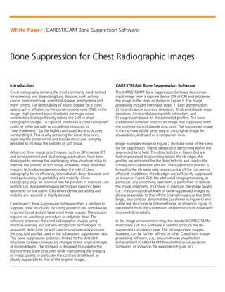 White Paper | CARESTREAM Bone Suppression Software
Bone Suppression for Chest Radiographic Images
Introduction
Chest radiography remains the most commonly used method
for screening and diagnosing lung diseases, such as lung
cancer, pneumothorax, interstitial disease, emphysema and
many others. The detectability of a lung disease on a chest
radiograph is affected by the signal-to-noise ratio (SNR) in the
image. High-contrast bone structures are major noise
contributors that significantly reduce the SNR in chest
radiographic images. A signal of interest in a chest radiograph
could be either partially or completely obscured, or
“overshadowed,” by the highly contrasted bone structures
surrounding it. This is why removing the bone structures,
especially the posterior rib and clavicle structures, is highly
desirable to increase the visibility of soft tissue.
Advanced X-ray imaging techniques, such as 3D imaging (CT
and tomosynthesis) and dual-energy subtraction, have been
developed to remove the overlapping bone-structure noise to
improve the visibility of soft tissue. However, these advanced
imaging technologies cannot replace the role of chest
radiography for its efficiency, low radiation dose, low cost, and
most particularly, its portability and mobility. Chest
radiography plays an essential role for patients in intensive care
units (ICUs). Advanced imaging techniques have not been
optimized for the use in ICUs where device portability and
mobility are required or highly desired.
Carestream’s Bone Suppression Software offers a solution to
suppress bone structures, including posterior ribs and clavicles,
in conventional and portable chest X-ray images. The solution
requires no additional procedure or radiation dose. The
software processes the chest radiographic images using
machine-learning and pattern-recognition technologies to
accurately detect the rib and clavicle structures and estimate
the structure profiles used in the subsequent suppression step.
This bone-suppression process is limited to the detected
structures to keep unnecessary changes to the original images
at minimal levels. The software is designed to suppress the
high-contrast bone structures while maintaining the integrity
of image quality, in particular the contrast-detail level, as
closely as possible to that of the original images.
CARESTREAM Bone Suppression Software
The CARESTREAM Bone Suppression Software takes in an
input image from a capture device (DR or CR) and processes
the image in the steps as shown in Figure 1. The image
processing includes five major steps: 1) lung segmentation,
2) rib and clavicle structure detection, 3) rib and clavicle edge
detection, 4) rib and clavicle profile estimation, and
5) suppression based on the estimated profiles. The bone-
suppression software outputs an image that suppresses both
the posterior rib and clavicle structures. The suppressed image
is then enhanced the same way as the original image for
visualization, and used as a companion view.
Image examples shown in Figure 2 illustrate some of the steps
for rib suppression. The rib detection is performed within the
segmented lung field. The detected ribs in Figure 2(c) are
further processed to accurately detect the rib edges. Rib
profiles are estimated for the detected ribs and used in the
subsequent suppression process. The suppression process is
limited to the rib areas only; areas outside of the ribs are not
affected. In addition, the rib edges are sufficiently suppressed
as shown in Figure 2(d). No additional image processing, in
particular, any smoothing operation, is performed to reduce
the image sharpness. It’s critical to maintain the image quality
(i.e., the contrast-detail level) of bone-suppressed images as
closely as possible to that of the original images so that both
larger, low-contrast abnormalities (as shown in Figure 4) and
subtle line structures (a pneumothorax, as shown in Figure 3)
can benefit from the suppression of bone structure noise with
improved detectability.
In the image-enhancement step, the standard CARESTREAM
DirectView EVP Plus Software is used to produce the rib-
suppressed companion view. The rib-suppressed images,
however, can be further refined by other Carestream image-
processing software, e.g., pneumothorax visualization
enhancement (CARESTREAM Pneumothorax Visualization
Software), as shown in the example in Figure 3(c).
 