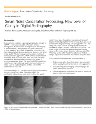White Paper | Smart Noise Cancellation Processing
Technical Brief Series
Smart Noise Cancellation Processing: New Level of
Clarity in Digital Radiography
Authors: Karin Toepfer (Ph.D.), Lori Barski (MS), Jim Sehnert (Ph.D.) and Levon Vogelsang (Ph.D.)
Introduction
Best practice in medical X-ray imaging employs the principle of
ALARA – “as low as reasonably achievable” for dose
management. A consequence of this principle is that imaging
is performed with a dose just high enough to confidently
achieve diagnosis.1
As a result, images tend to contain noise
that reduces clarity and masks anatomical structures that affect
image quality. Medical image processing utilizes traditional
noise-suppression approaches, which can lead to some loss of
fine image detail. In recent years, noise reduction with deep
convolutional neural networks (CNN) has been shown to
preserve more image detail.2
The benefits of CNN-based noise
reduction are improved image quality, increased contrast-to-
noise, easier-to-read radiographs, and the potential for
additional dose reduction.
Carestream Health, Inc., has developed a CNN-based denoising
approach called Smart Noise Cancellation (SNC) that
significantly reduces image noise while it retains fine spatial
detail.3
Smart Noise Cancellation is an optional feature of
Eclipse, the intelligent platform that serves as the backbone of
Carestream’s image processing. The synergy of the two – SNC
along with Eclipse – results in image quality that is truly
remarkable. Figure 1 provides a visual illustration of SNC. The
image on the left shows the noisy calcaneus as originally
captured. The center picture shows the calcaneus after SNC.
The image on the right, the difference between the two
images, represents a noise field that contains no spatial detail.
This advanced denoising method promises benefits in:
• Gridless imaging (i.e. SmartGrid), where the removal of
scatter typically leads to an increase in noise appearance.
• Neonatal and pediatric imaging, where imaging at the
lowest possible dose is critical.
• General radiography, to improve the clarity of anatomical
features in the processed images.
Figure 1. Left image – Noisy image; Center image – Image after SNC; Right image – Predicted noise field shown with a window of
-13 to + 13 code values.
 