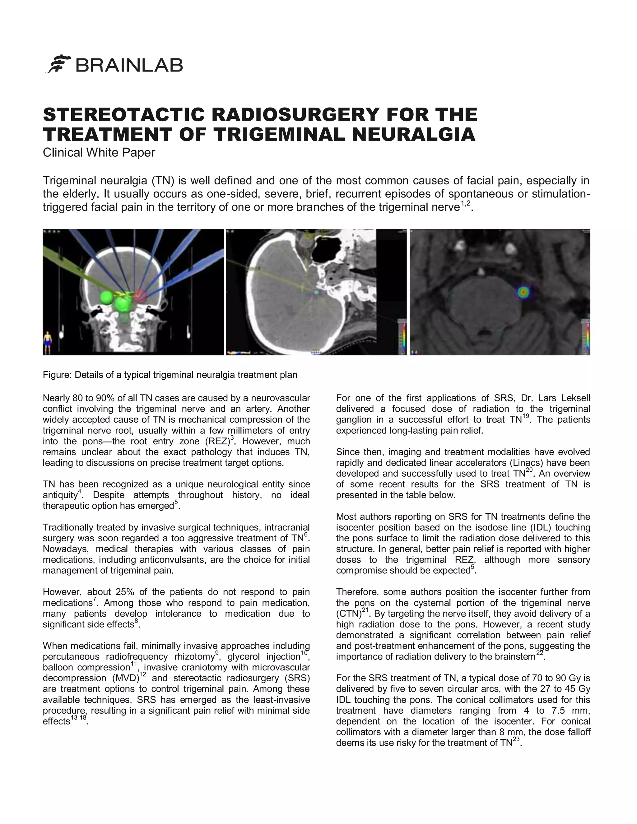 Stereotactic Radiosurgery for the Treatment of Trigeminal Neuralgia Clinical White Paper PDF