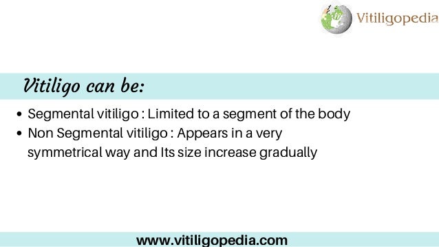 White Patches Treatment In Delhi | Treatment for Vitiligo ...