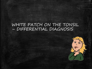WHITE PATCH ON THE TONSIL
– DIFFERENTIAL DIAGNOSIS
 