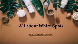 All about White Spots
BY – WWW.CREATIVEADITI.COM
 