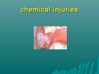 chemical injuries

 