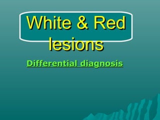 White & Red
lesions
Differential diagnosis

 