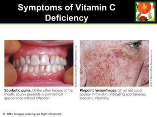 © 2016 Cengage Learning. All Rights Reserved.
Symptoms of Vitamin C
Deficiency
 