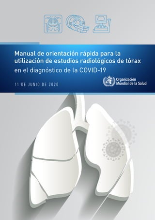 11 D E J U N I O D E 2 0 2 0
Manual de orientación rápida para la
utilización de estudios radiológicos de tórax
en el diagnóstico de la COVID-19
 