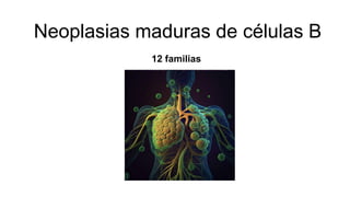 Neoplasias maduras de células B
12 familias
 