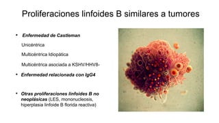 Proliferaciones linfoides B similares a tumores
• Enfermedad de Castleman
Unicéntrica
Multicéntrica Idiopàtica
Multicéntrica asociada a KSHV/HHV8-
• Enfermedad relacionada con IgG4
• Otras proliferaciones linfoides B no
neoplásicas (LES, mononucleosis,
hiperplasia linfoide B florida reactiva)
 