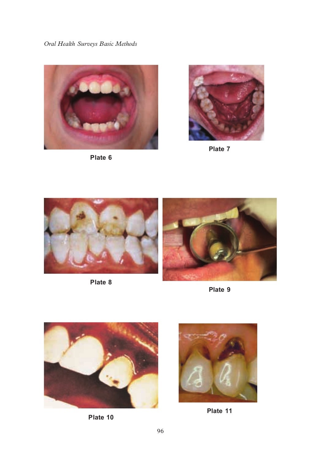 Who oralhealthsurveysbasicmethods5thedition2013