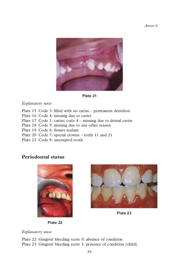 Who oralhealthsurveysbasicmethods5thedition2013