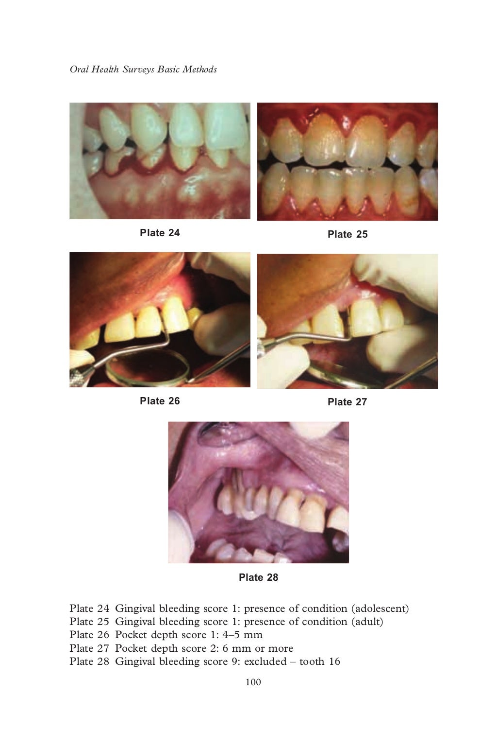 Who oralhealthsurveysbasicmethods5thedition2013