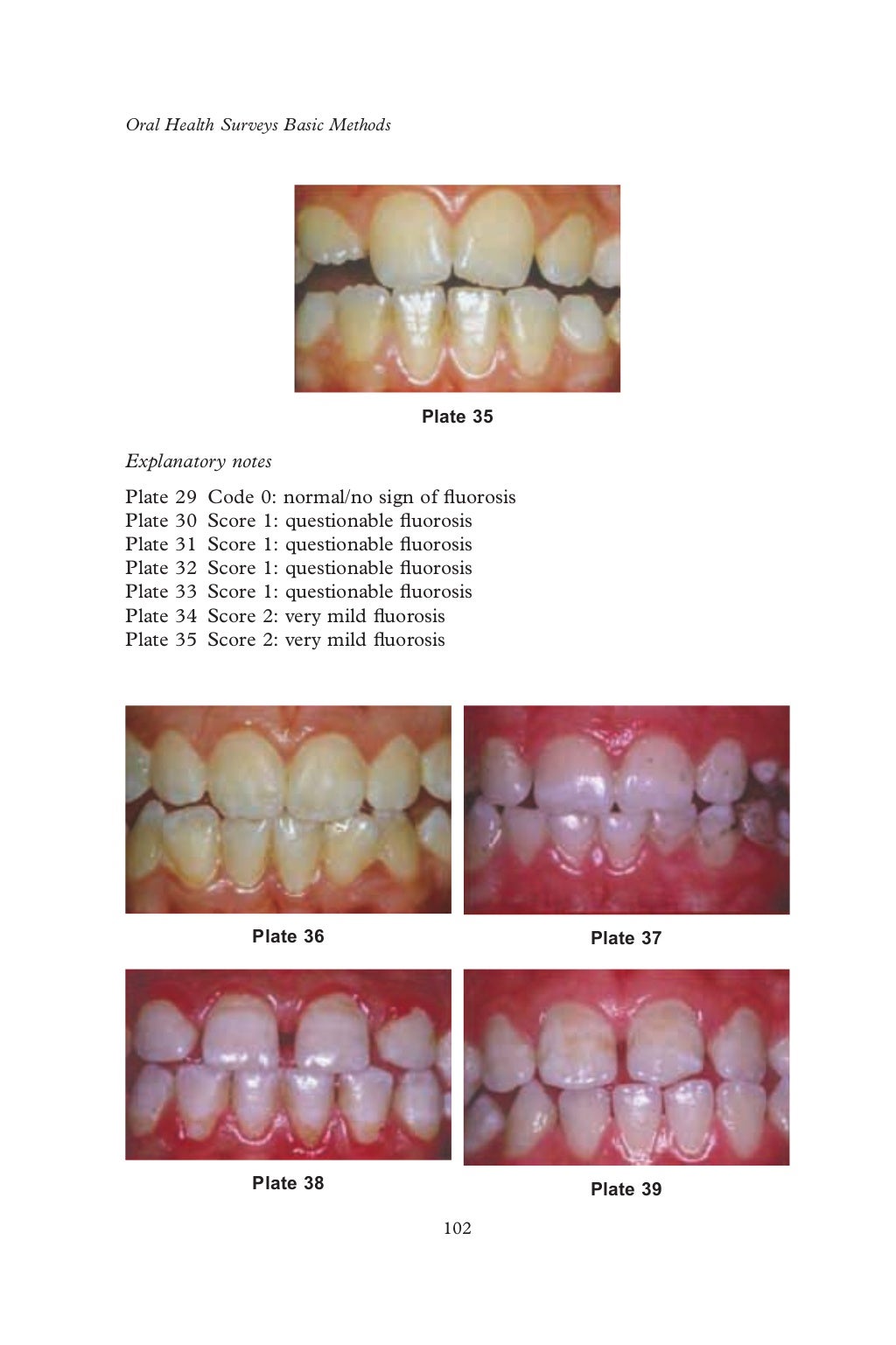 Who oralhealthsurveysbasicmethods5thedition2013