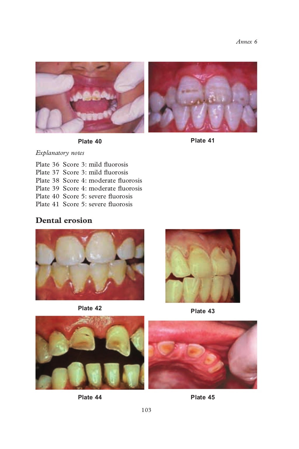 Who oralhealthsurveysbasicmethods5thedition2013